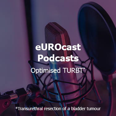 eUROcast Podcasts: Optimised TURBT* *Transurethral resection of a bladder tumour