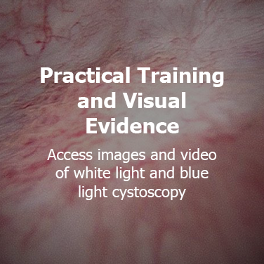 Practical Training and Visual Evidence: Access images and video of white light and blue light cystoscopy